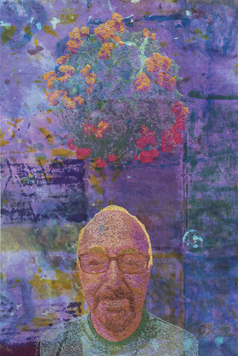 mantle_cell_lymphoma